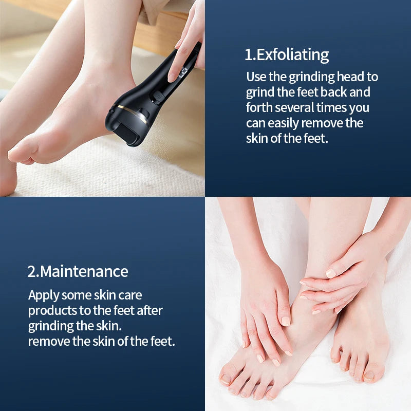 Rechargeable Electric Callus Remover — Adjustable Speed