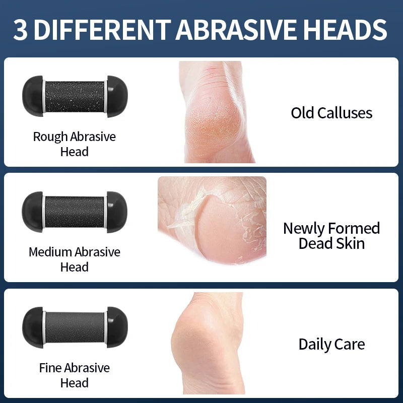 Rechargeable Electric Callus Remover — Adjustable Speed