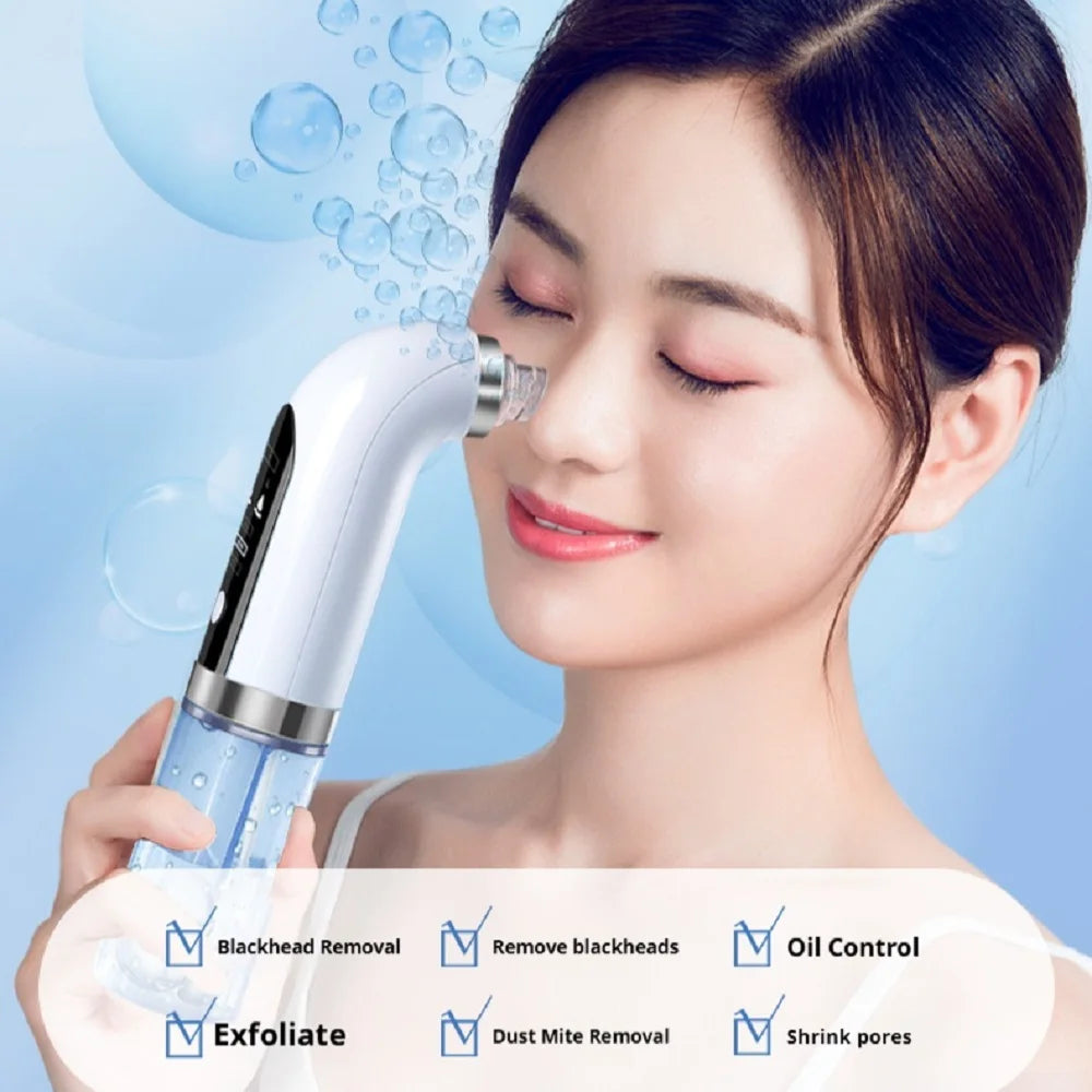 Electric Blackhead Remover Pore Vacuum — USB Rechargeable